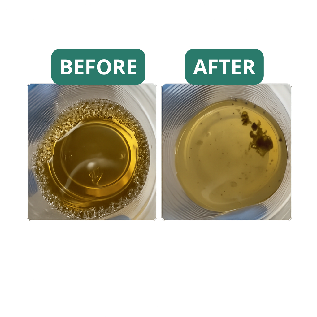 Before and After Sevaros Clean